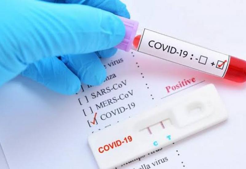 Total 91 Kasus, Hari Ini 3 Warga Kota dan 2 Nakes BU Positif Covid-19/google