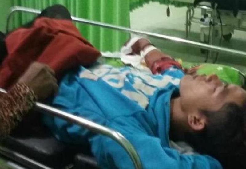 Dibegal Serta Tangan Ditebas, Motor Seorang Remaja Raib