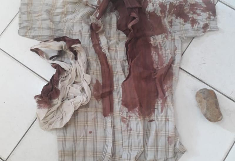 Aniaya Seseorang Hingga Berlumuran Darah, Jukir Terancam 2 Tahun Penjara